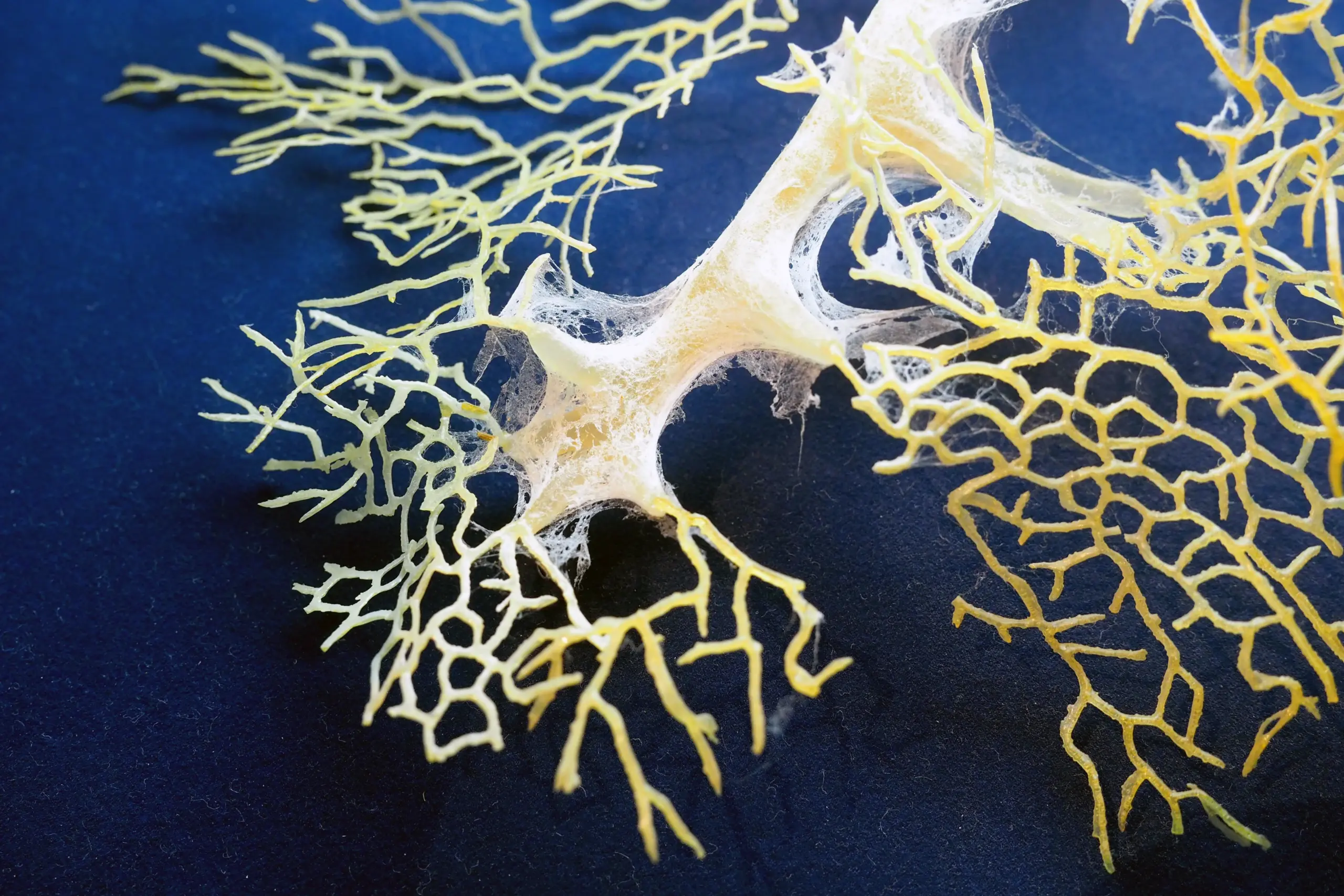 Learning what is dopamine and how it affects brain chemistry at Deluxe Treatment Center.